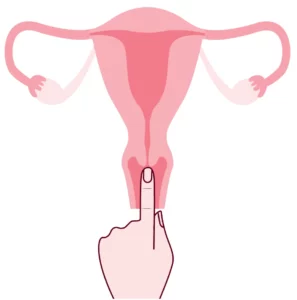 Średnio położona szyjka macicy