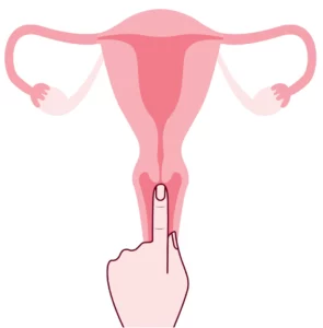 Wysoko położona szyjka macicy