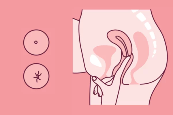 jak zmierzyć wysokość szyjki macicy