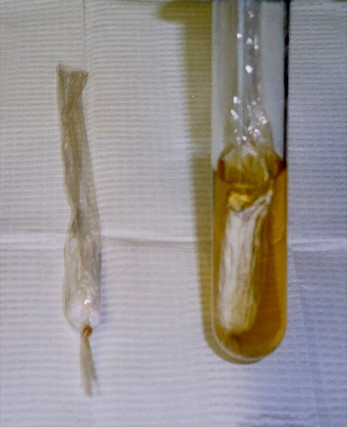 dlaczego tampony powodują TSS