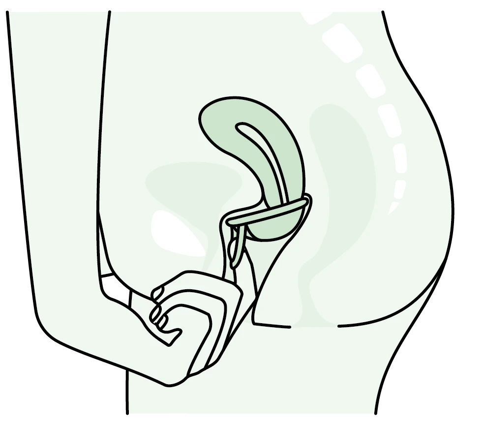 jak wyjąć dysk menstruacyjny