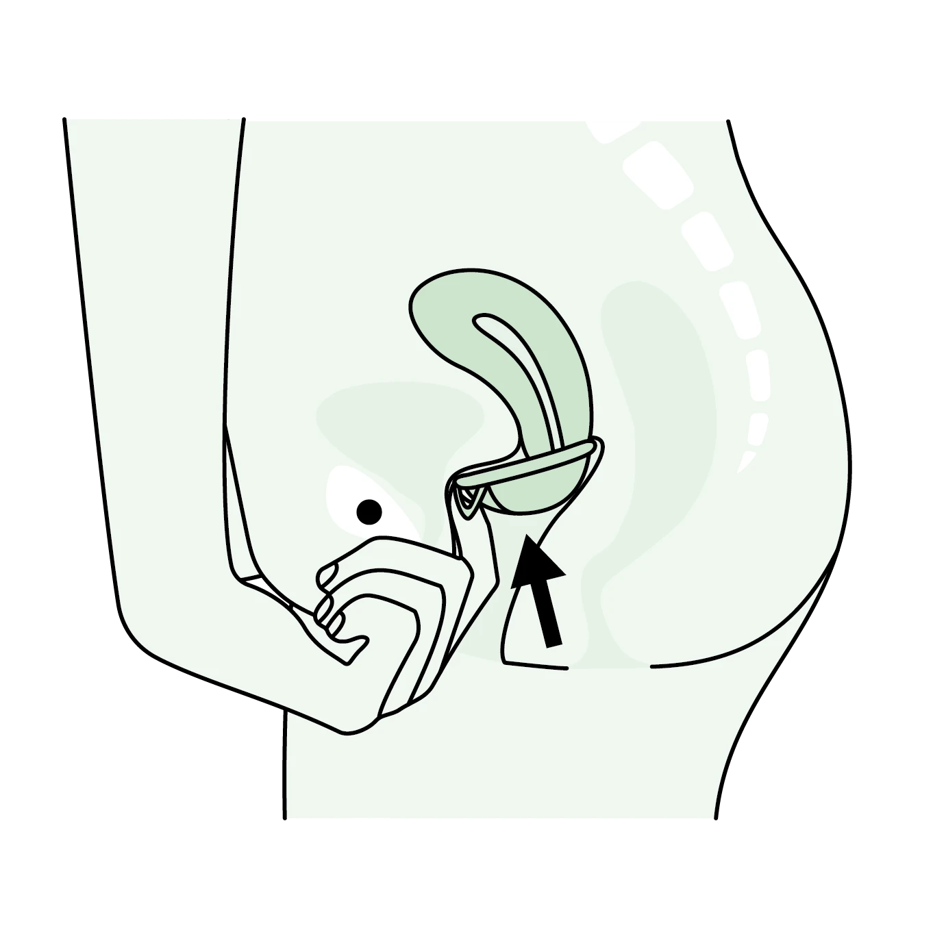 założenie dysku menstruacyjnego