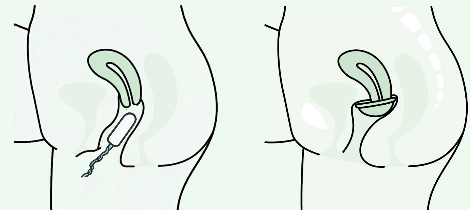 tampon a dysk menstruacyjny